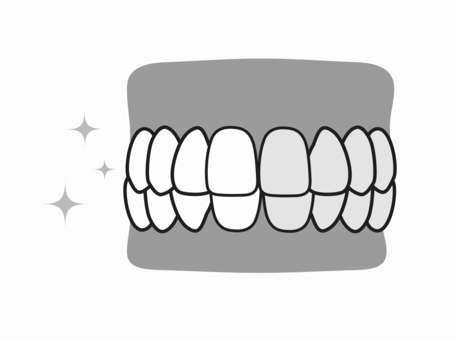 歯5